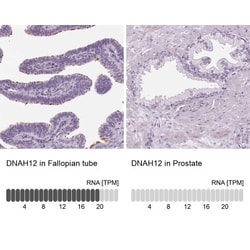 DNAH12 Antibody, Novus Biologicals 25 &mu;L, Unlabeled:Antibodies, Polyclonal